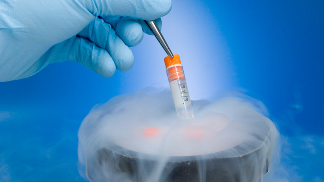 What Are The Benefits Of Getting Cryogenics
